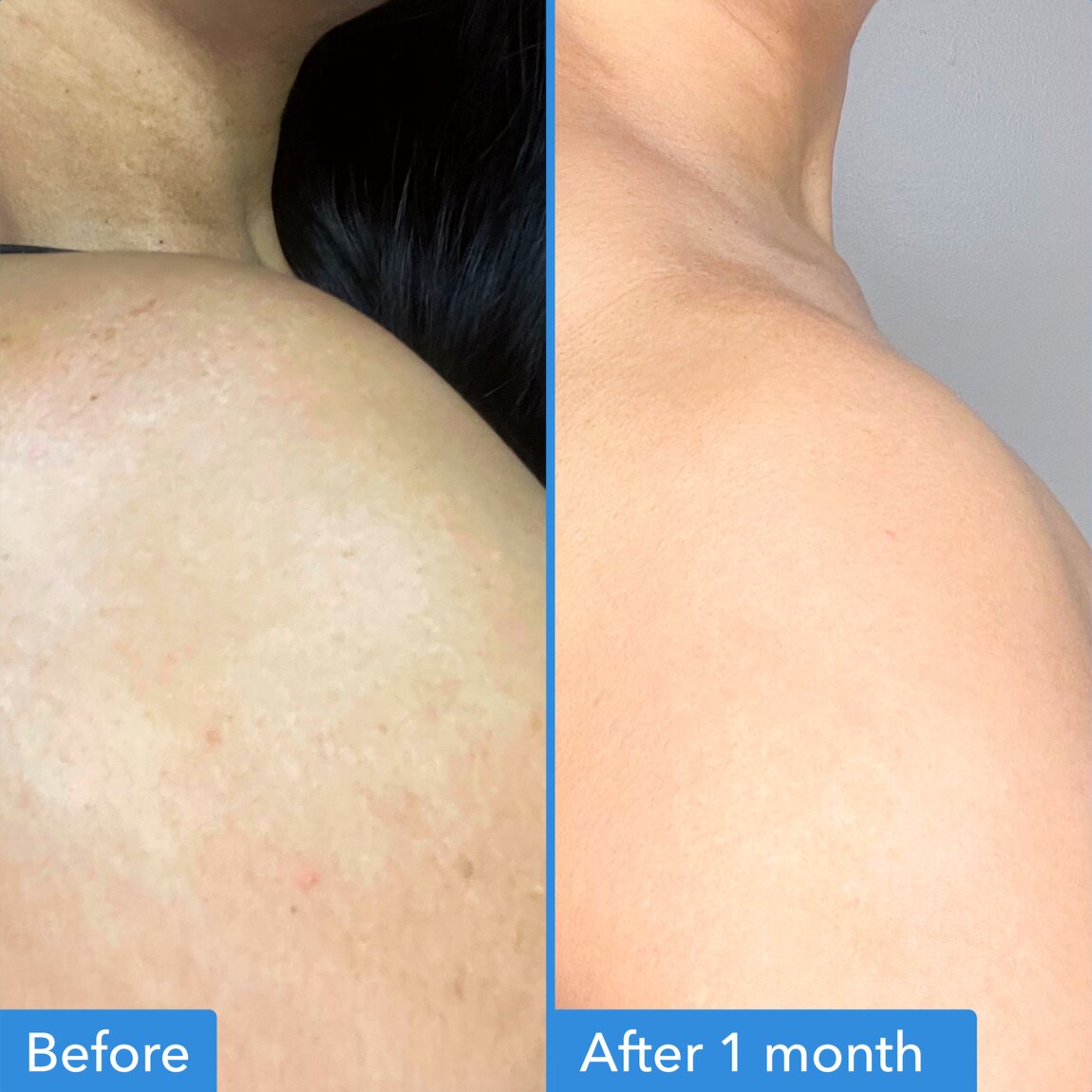 discoloration-correcting-body-treatment-l6 zb_p.jpg
