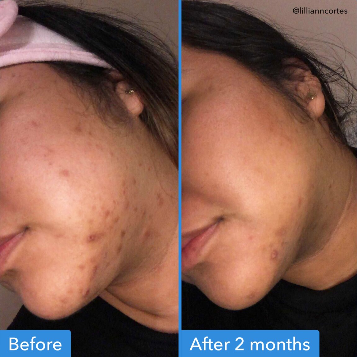 discoloration-correcting-serum-u9 zb_p.jpg