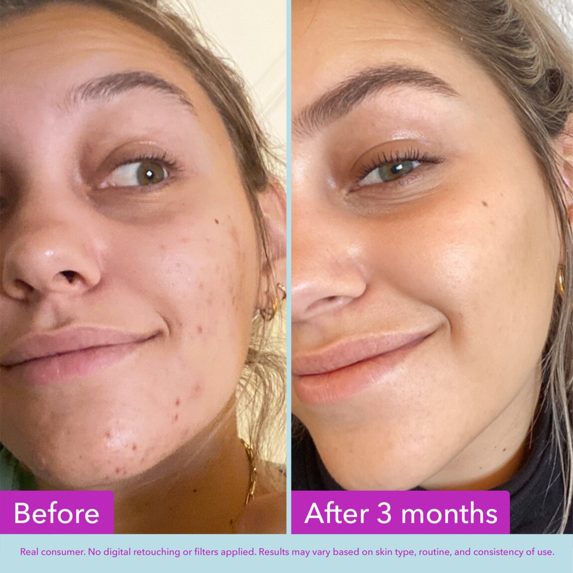 niacinamide-brightening-toner-o1 zb_p.jpg