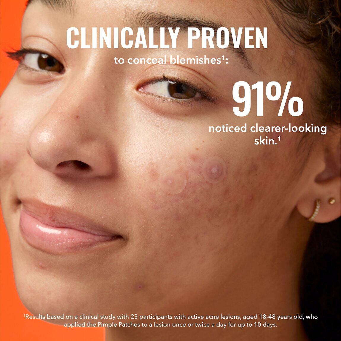 pimple-patches-d6 zb_p.jpg